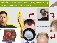 Nima uchun DHT prostata va soch tadqiqotida asosiy maqsadga aylandi