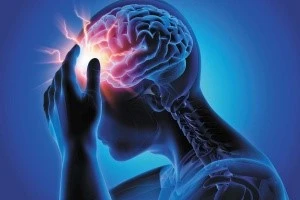 MK 677 Headache